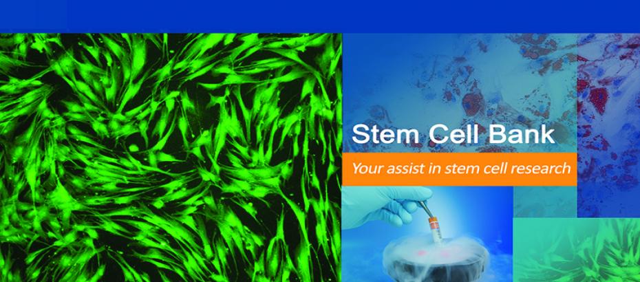 Human Bone Marrow derived Mesenchymal Stem Cells